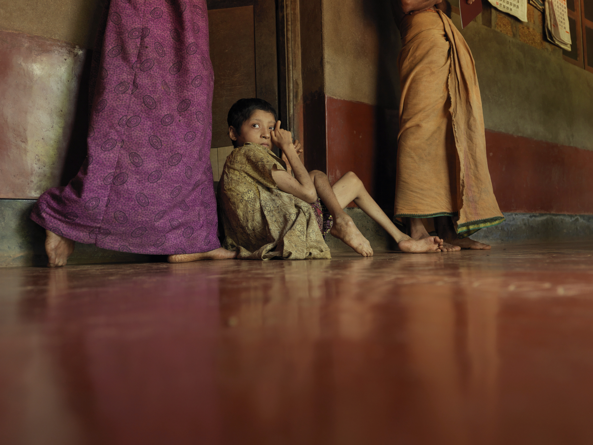 The Pesticide Poisoning by Peter Caton (UK)